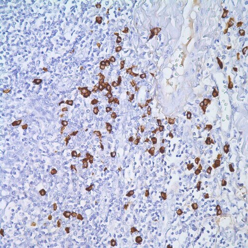 IHC of IgG4 Mmab on an FFPE Tonsil Tissue
